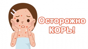 Внимание! Вспышка кори!