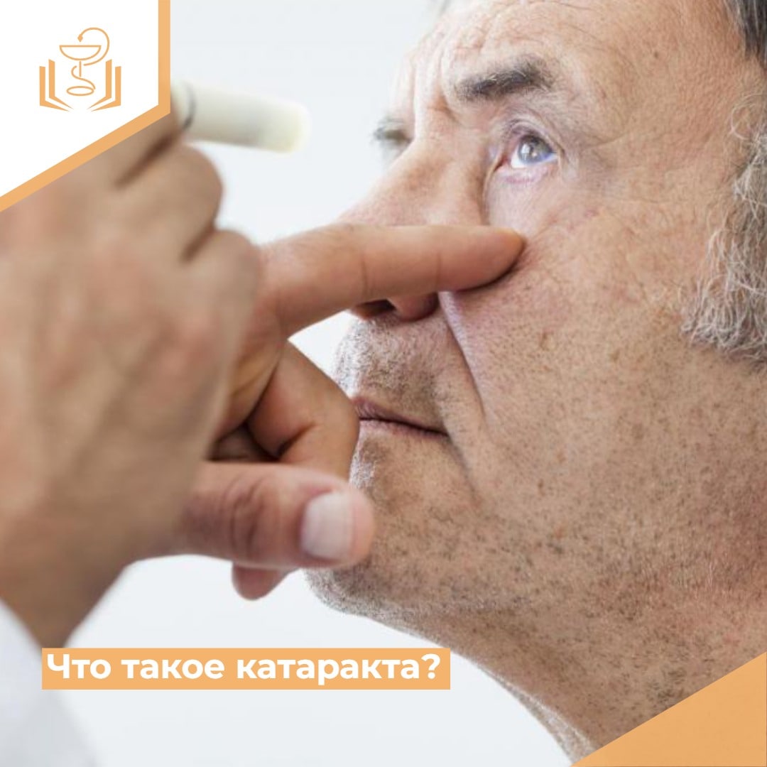 Что такое катаракта? Что такое катаракта?