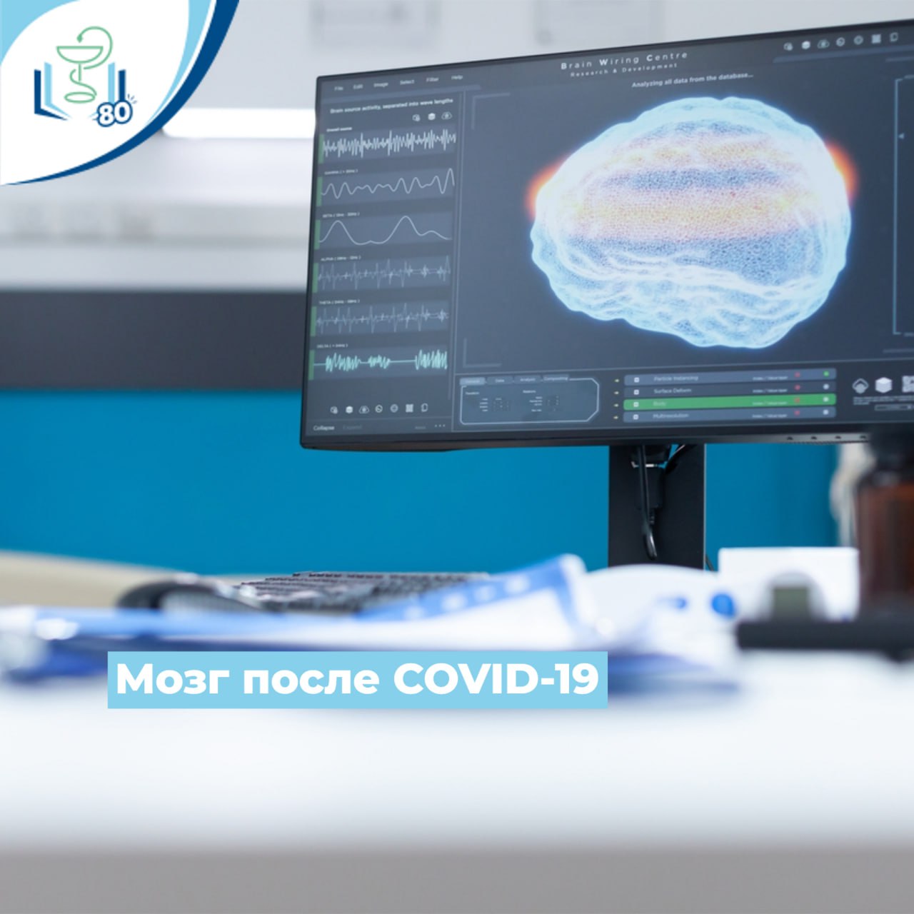 Мозг после COVID-19 Мозг после COVID-19