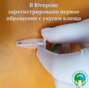 В БУ «Югорская городская больница» был зарегистрирован первый случай укуса клеща
