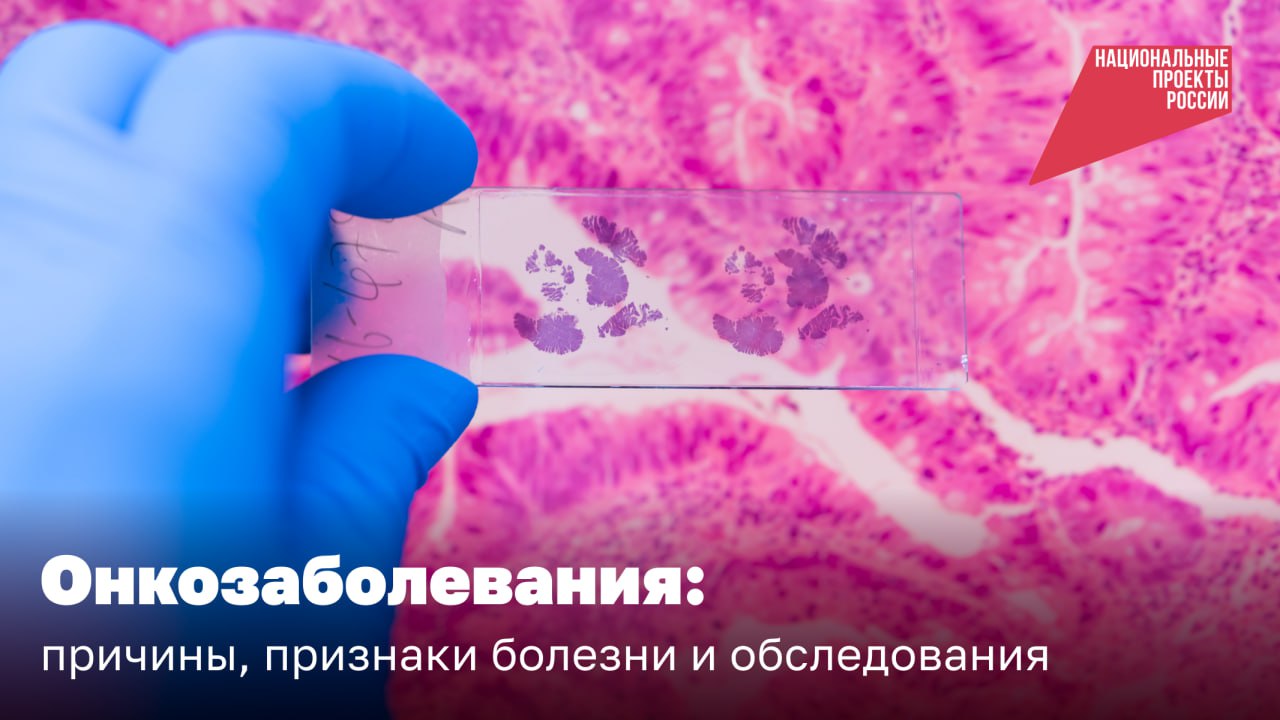 Онкозаболевания Онкозаболевания