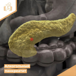 Алкогольный панкреатит