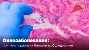Онкозаболевания