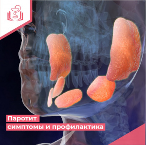 Паротит симптомы и профилактика