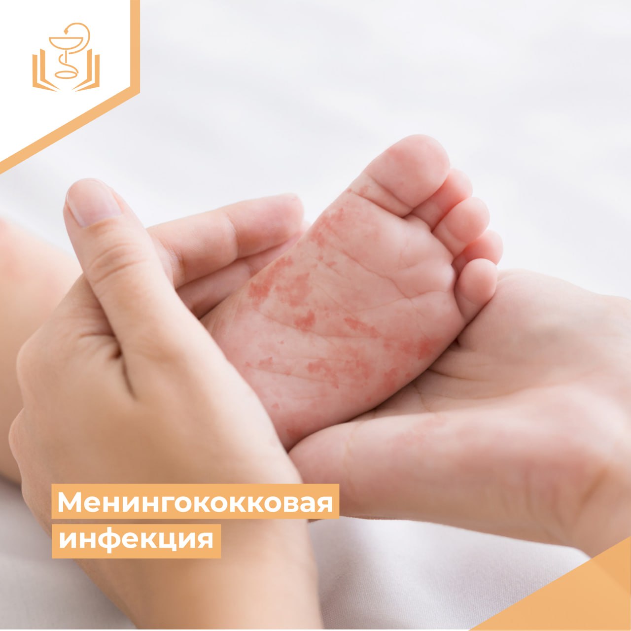 Менингококковая инфекция Менингококковая инфекция