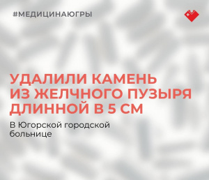 В Югорской городской больнице удалили пациентке камень из желчного пузыря длиной в 5 см