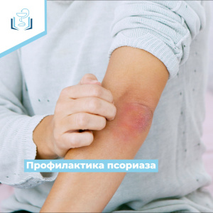 Профилактика псориаза