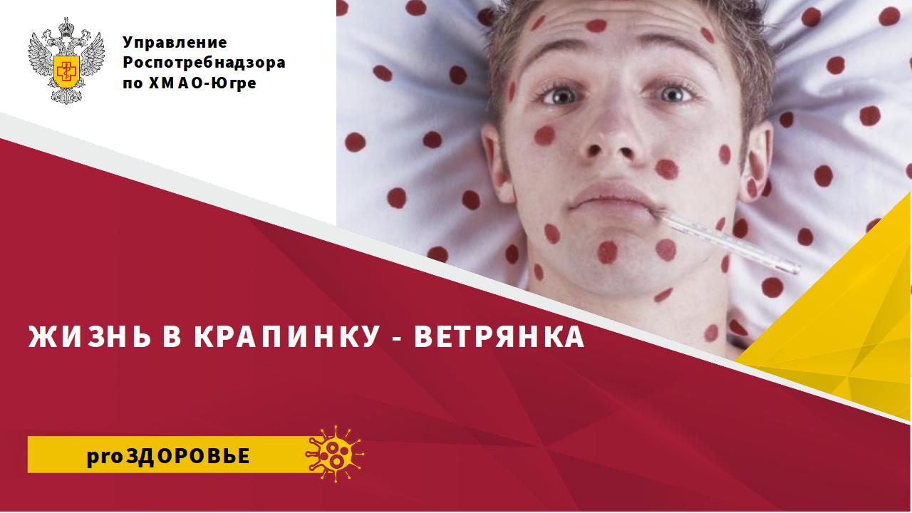 Жизнь в крапинку - ветрянка Жизнь в крапинку - ветрянка