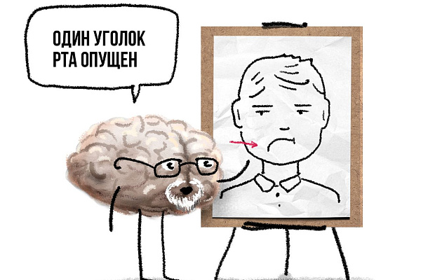 Как определить инсульт