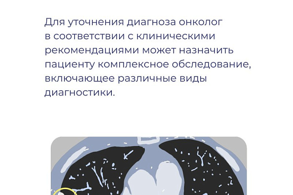 Откуда берется рак легкого