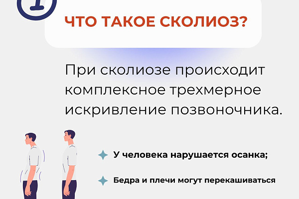6 вопросов о сколиозе
