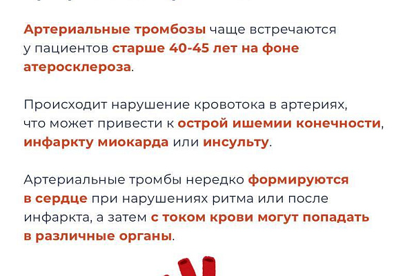Откуда берутся тромбы и как снизить риски