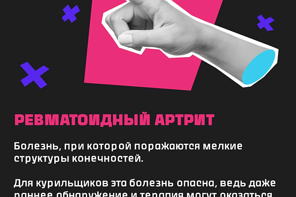 Как курение влияет на суставы?
