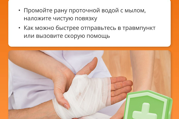 Дикие звери: как избежать встречи и что делать при укусе