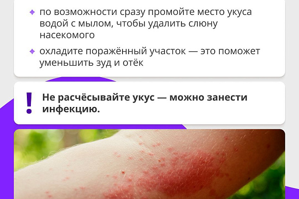 Укусы комаров: что нужно знать