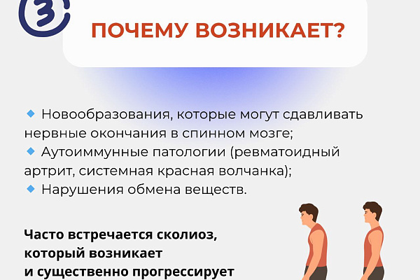 6 вопросов о сколиозе