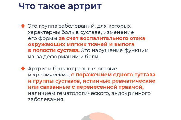 Что нужно знать при артрите