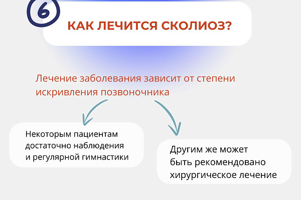 6 вопросов о сколиозе