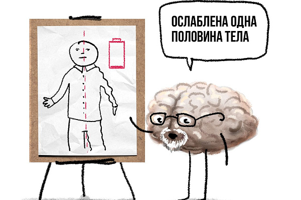 Как определить инсульт