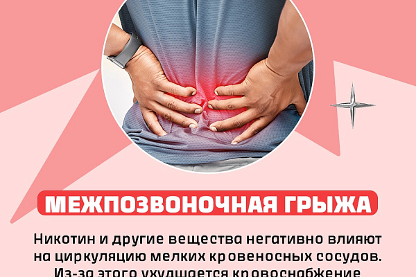 Бросаю курить и спасаю свои лёгкие. Или не только?!
